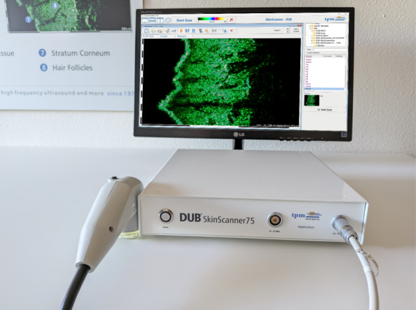 DUB SkinScanner75 newHousing